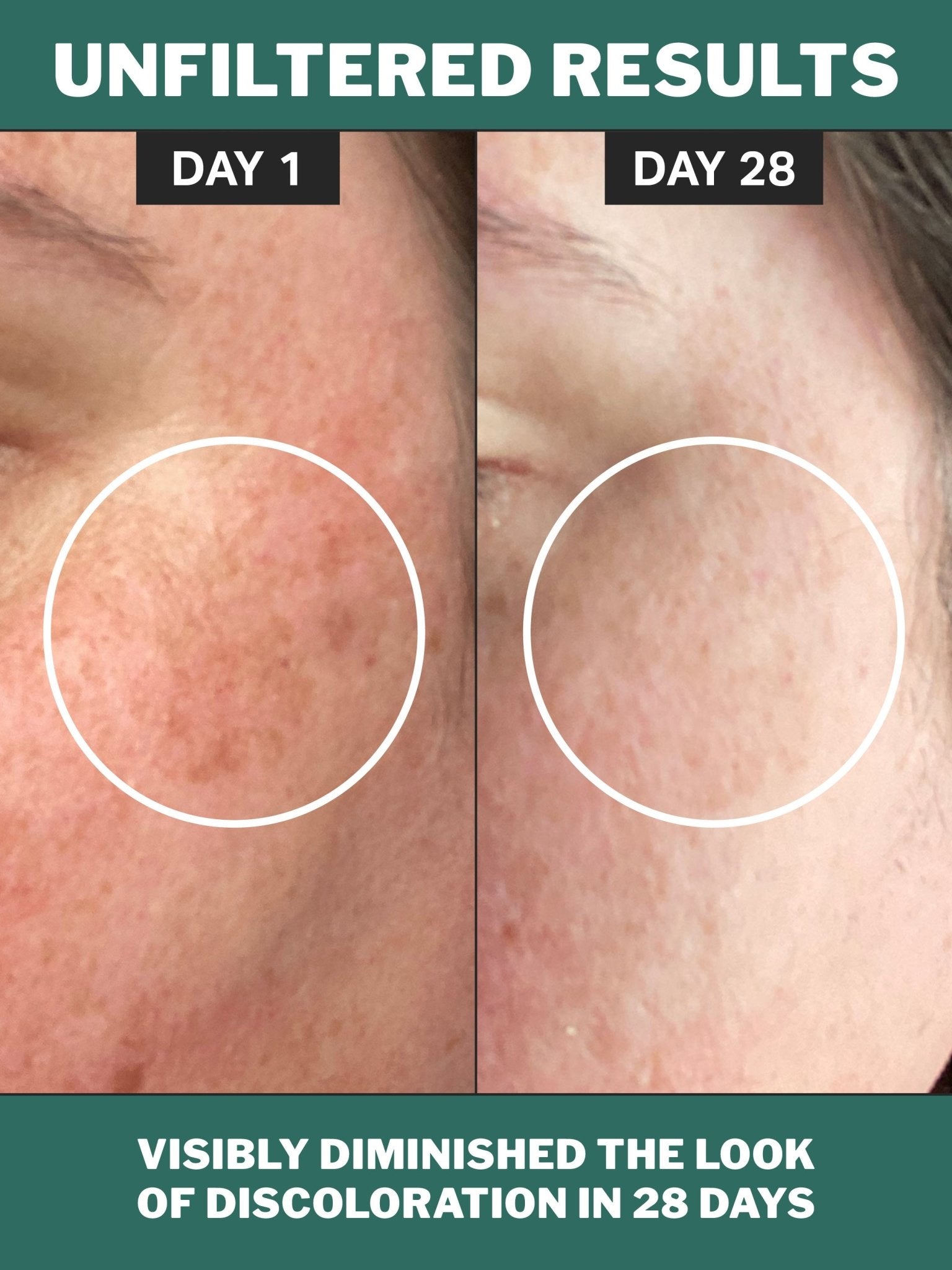 chlorophyll-discoloration-serum-660316.jpg